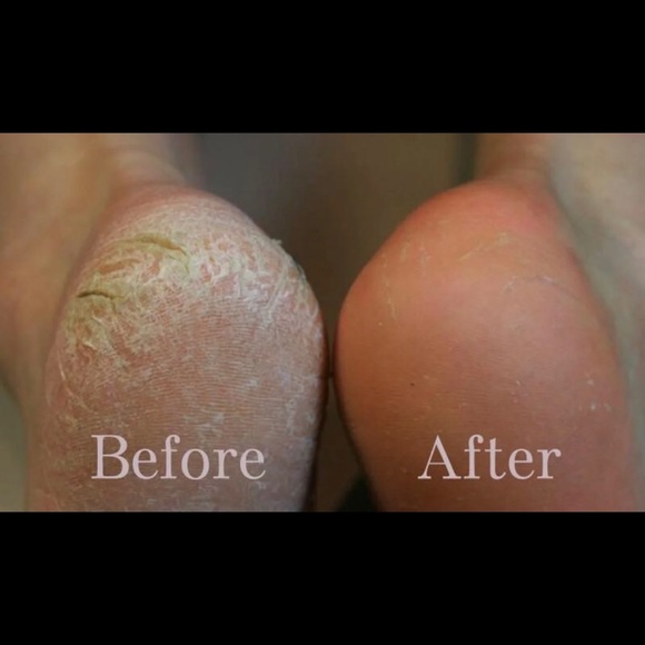 💄 SALE💄 NEW Grace & Stella Dr. Pedicure Foot Peel Mask, 1 - Picture 6 of 12
